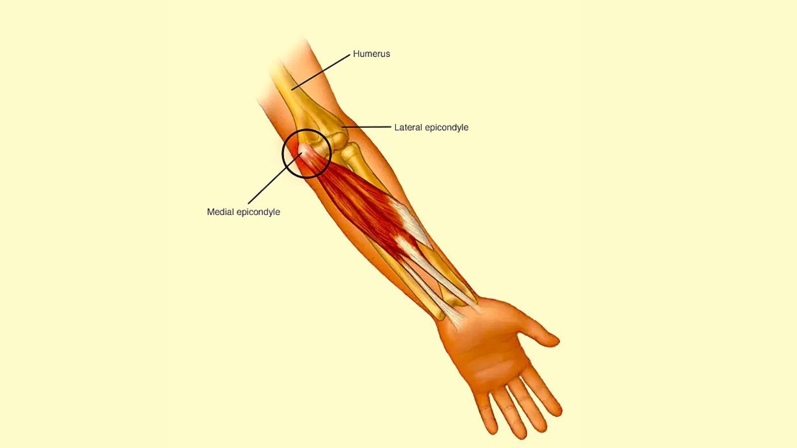Treatment Options