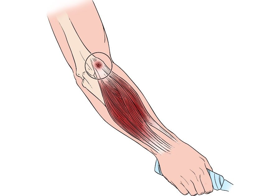 Treatment Options