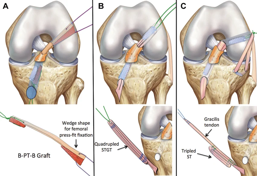 Treatment Options