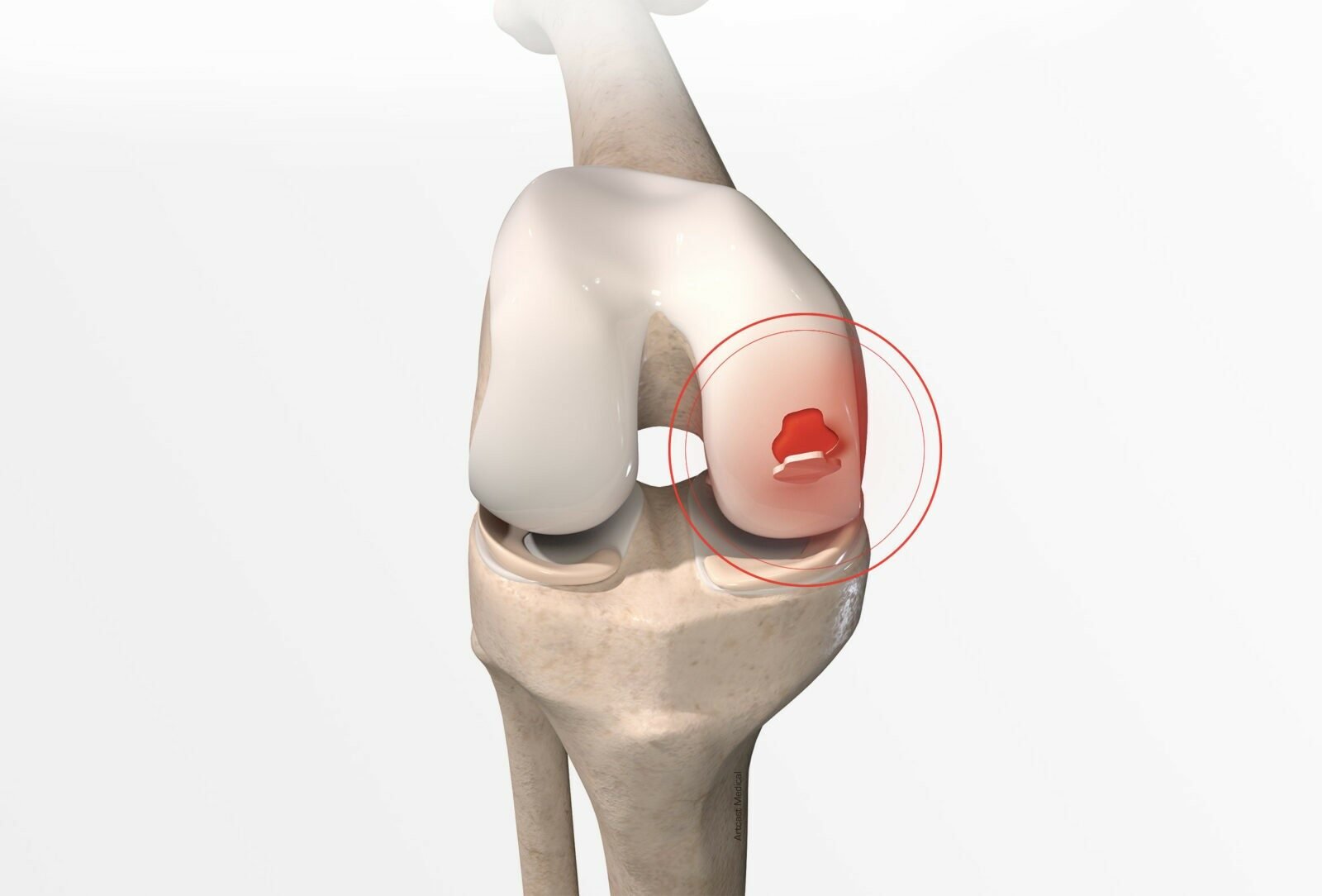 Treatment Options
