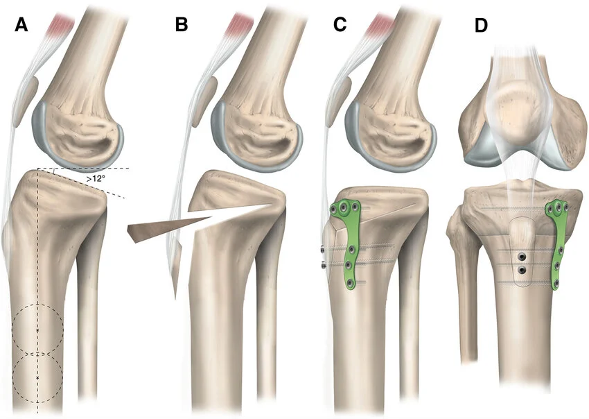 Treatment Options